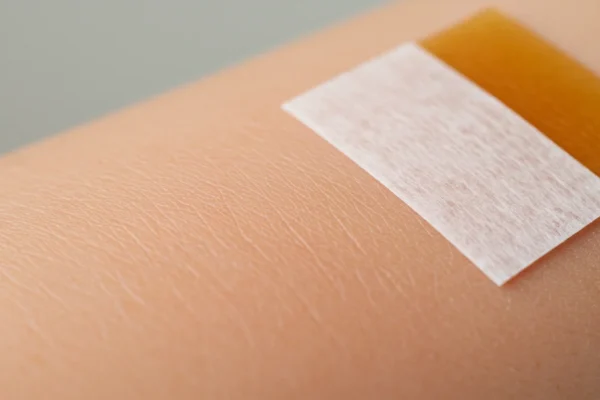 Sunburn Waxing: 2026 Risks for Your Skin