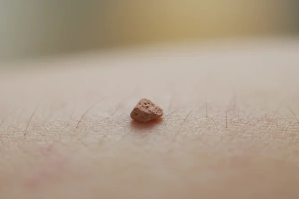 Waxing Reactions: 25% Face Skin Pain in 2026